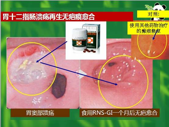 mg冰球突破豪华版(试玩)官方网站