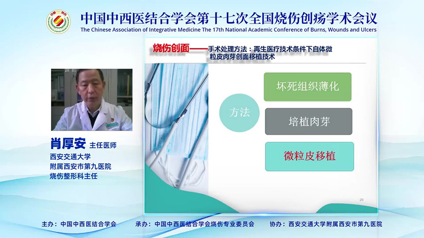 mg冰球突破豪华版(试玩)官方网站