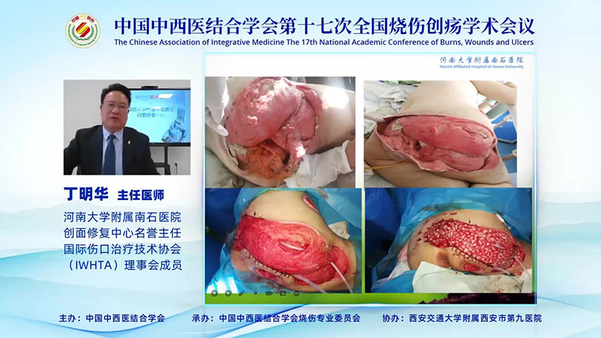 mg冰球突破豪华版(试玩)官方网站