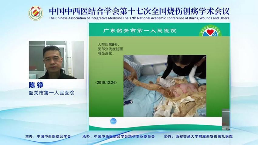 mg冰球突破豪华版(试玩)官方网站