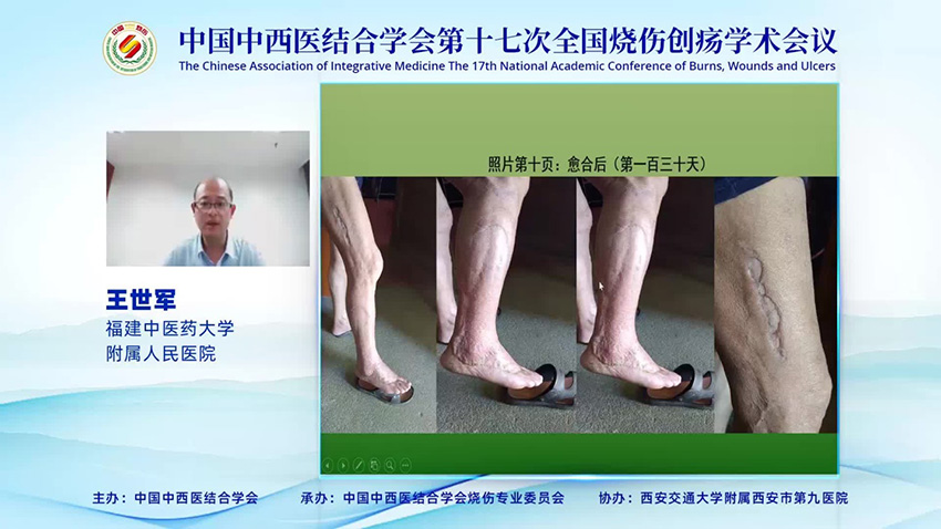 mg冰球突破豪华版(试玩)官方网站