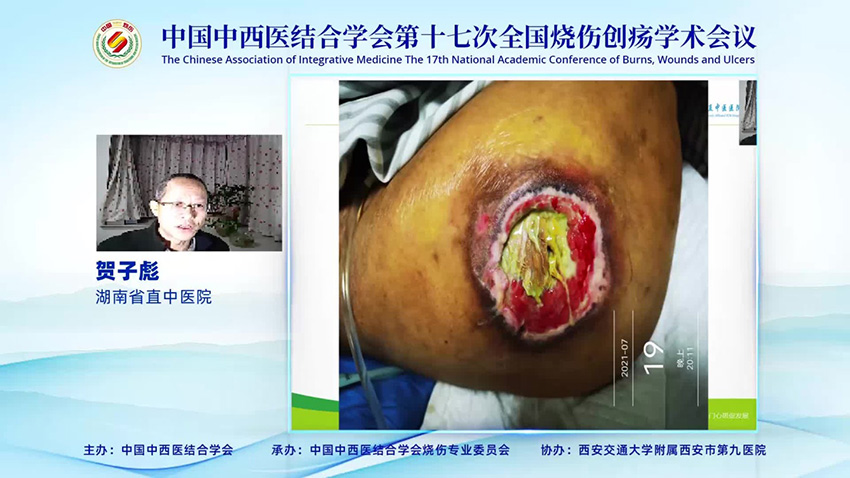 mg冰球突破豪华版(试玩)官方网站