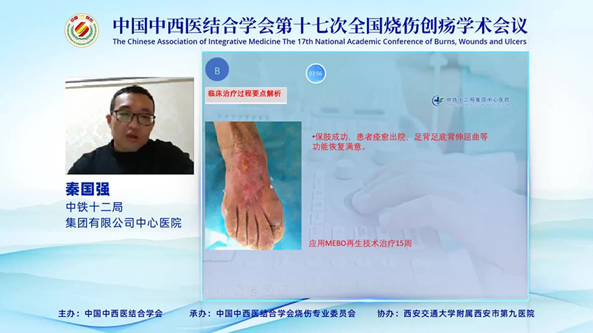 mg冰球突破豪华版(试玩)官方网站