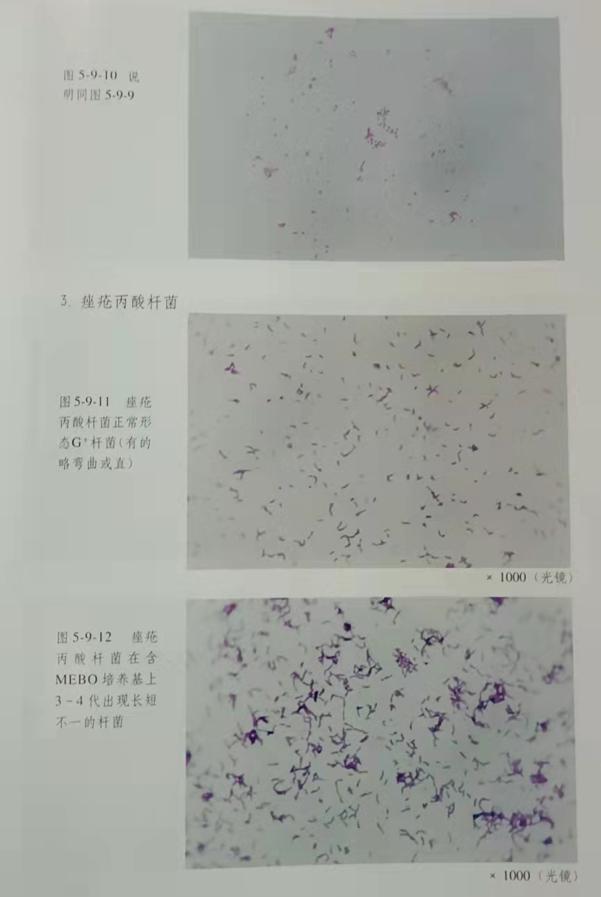 mg冰球突破豪华版(试玩)官方网站