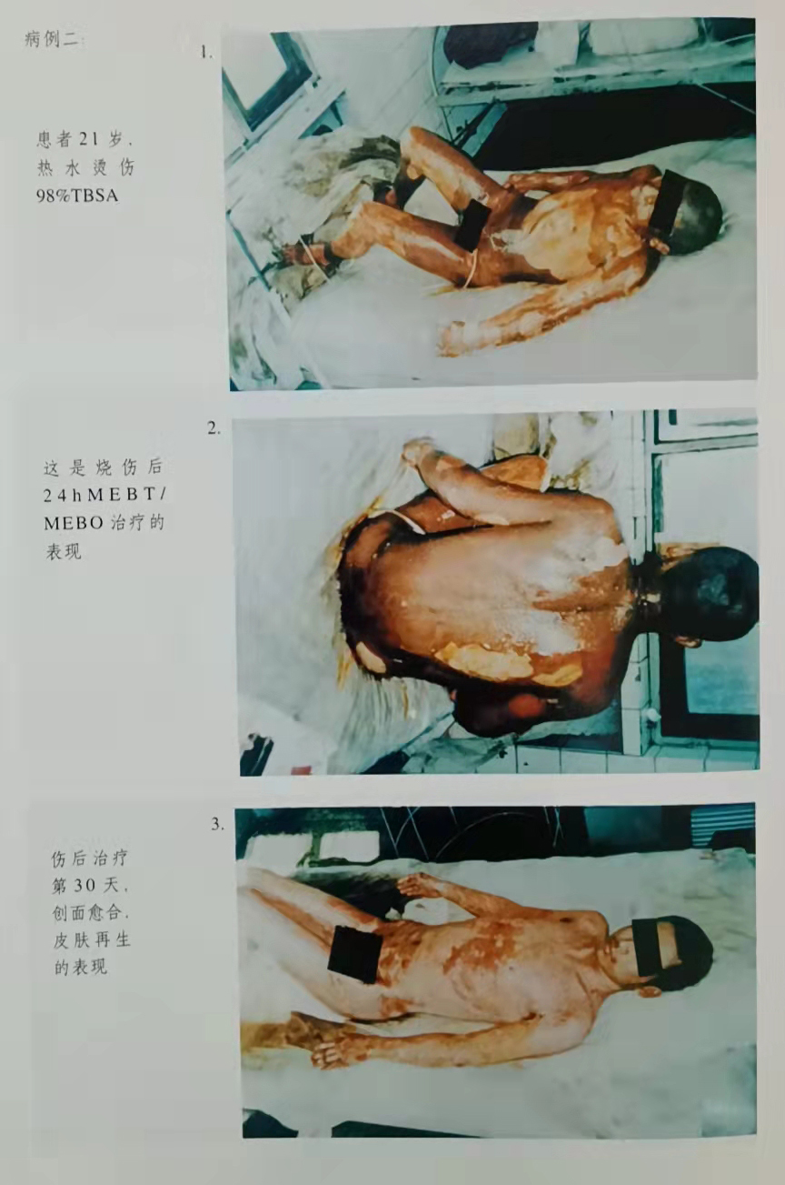 mg冰球突破豪华版(试玩)官方网站