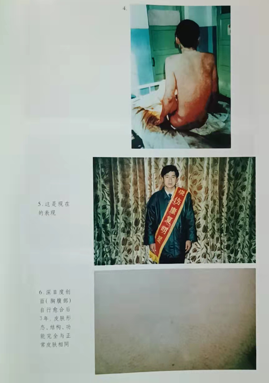 mg冰球突破豪华版(试玩)官方网站
