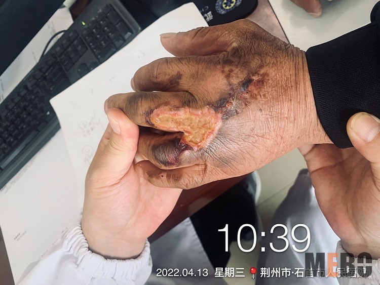 mg冰球突破豪华版(试玩)官方网站