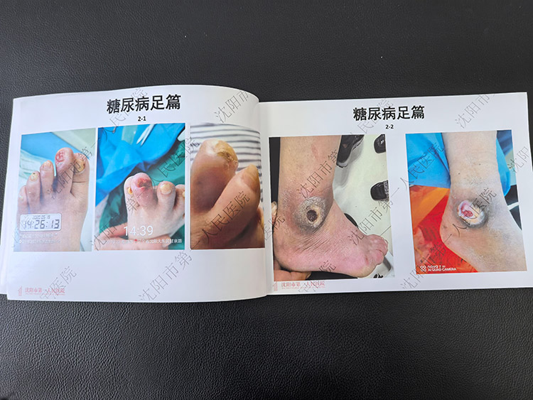 mg冰球突破豪华版(试玩)官方网站