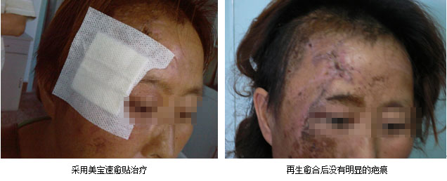 mg冰球突破豪华版(试玩)官方网站