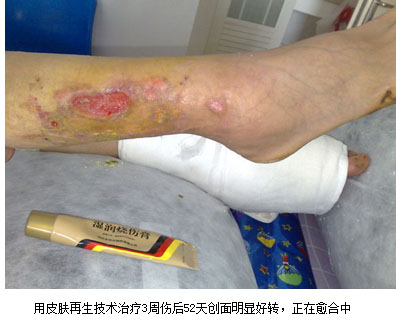 mg冰球突破豪华版(试玩)官方网站