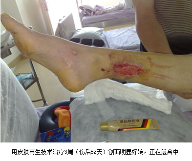 mg冰球突破豪华版(试玩)官方网站