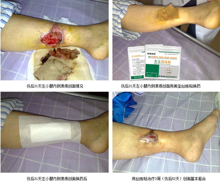 mg冰球突破豪华版(试玩)官方网站