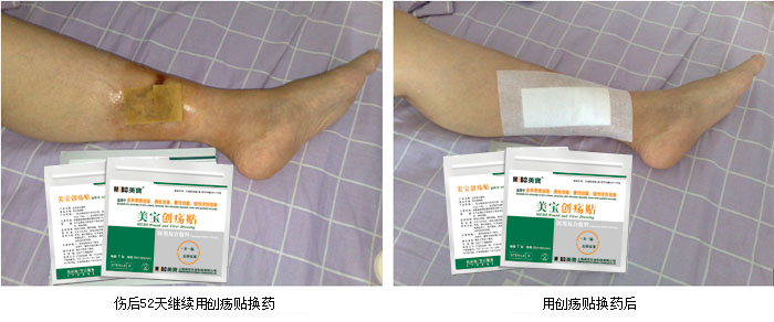 mg冰球突破豪华版(试玩)官方网站