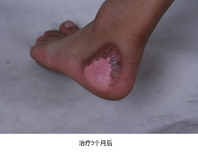mg冰球突破豪华版(试玩)官方网站