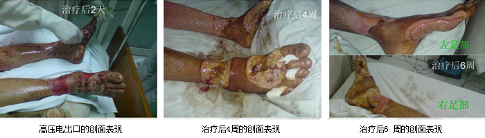 mg冰球突破豪华版(试玩)官方网站