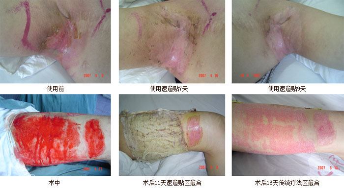 mg冰球突破豪华版(试玩)官方网站