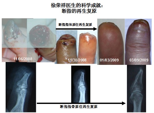 mg冰球突破豪华版(试玩)官方网站