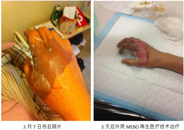 mg冰球突破豪华版(试玩)官方网站