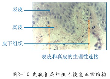 mg冰球突破豪华版(试玩)官方网站