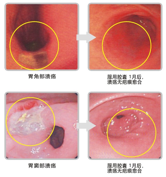 mg冰球突破豪华版(试玩)官方网站
