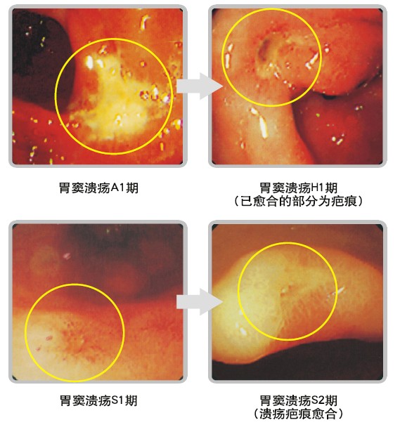 mg冰球突破豪华版(试玩)官方网站
