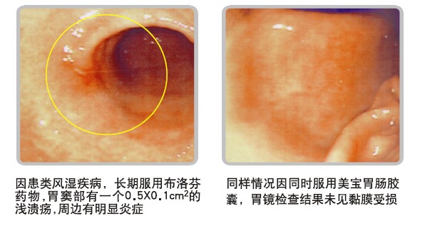 mg冰球突破豪华版(试玩)官方网站