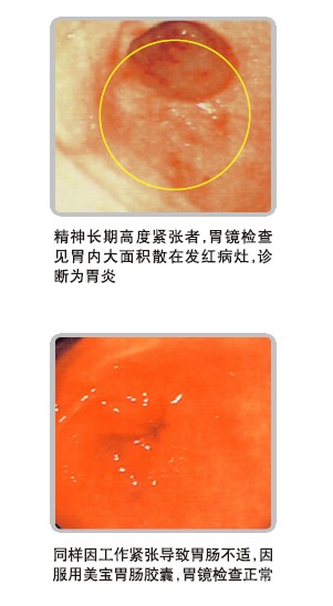 mg冰球突破豪华版(试玩)官方网站