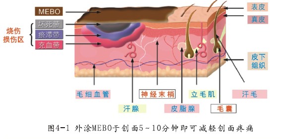 mg冰球突破豪华版(试玩)官方网站