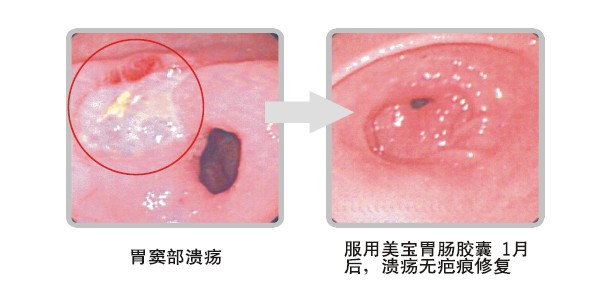 mg冰球突破豪华版(试玩)官方网站