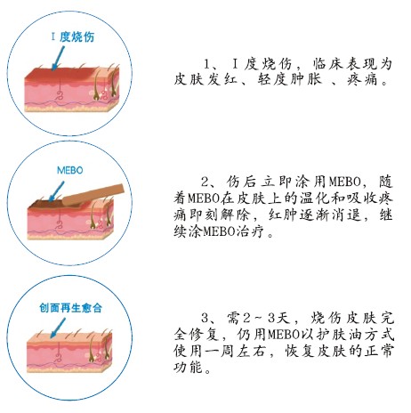 mg冰球突破豪华版(试玩)官方网站