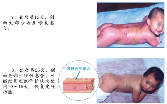 mg冰球突破豪华版(试玩)官方网站