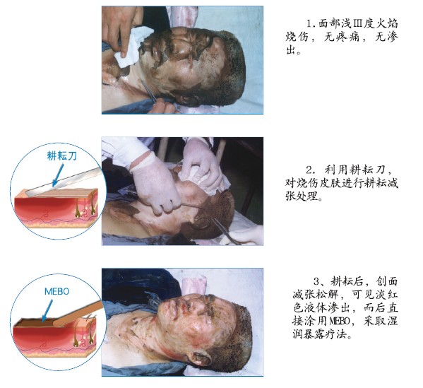 mg冰球突破豪华版(试玩)官方网站