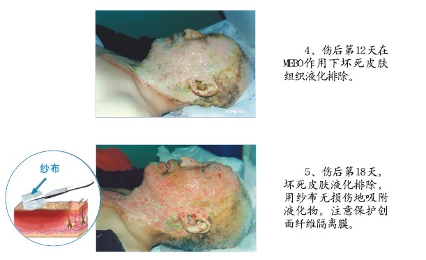 mg冰球突破豪华版(试玩)官方网站