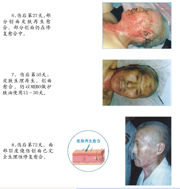 mg冰球突破豪华版(试玩)官方网站