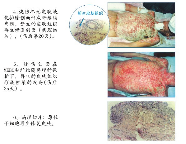 mg冰球突破豪华版(试玩)官方网站