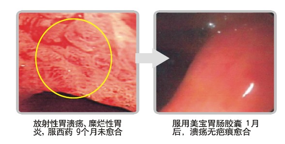 mg冰球突破豪华版(试玩)官方网站