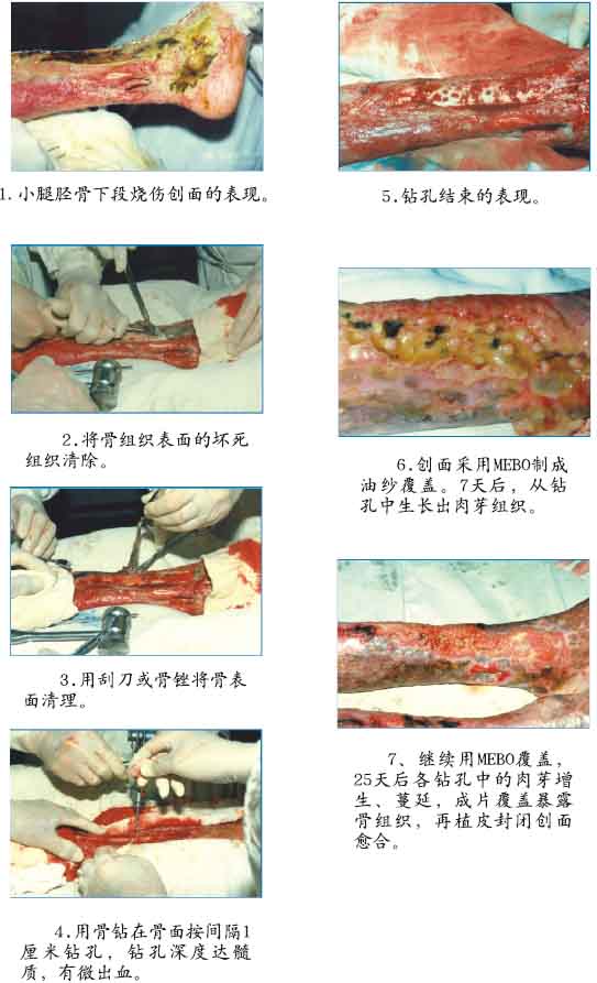 mg冰球突破豪华版(试玩)官方网站