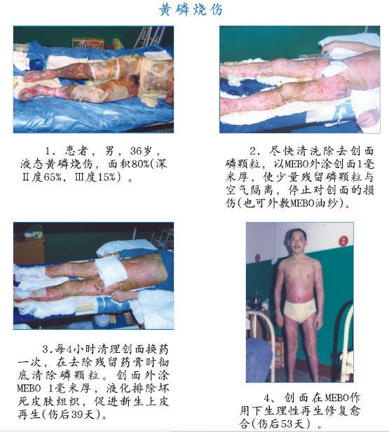 mg冰球突破豪华版(试玩)官方网站