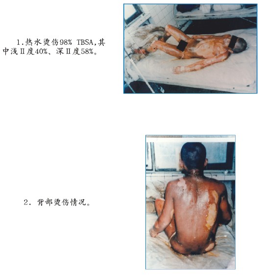 mg冰球突破豪华版(试玩)官方网站