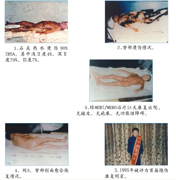 mg冰球突破豪华版(试玩)官方网站