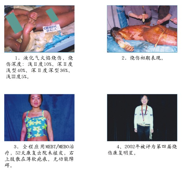 mg冰球突破豪华版(试玩)官方网站