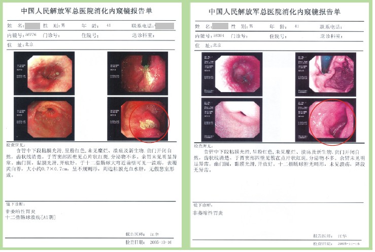 mg冰球突破豪华版(试玩)官方网站