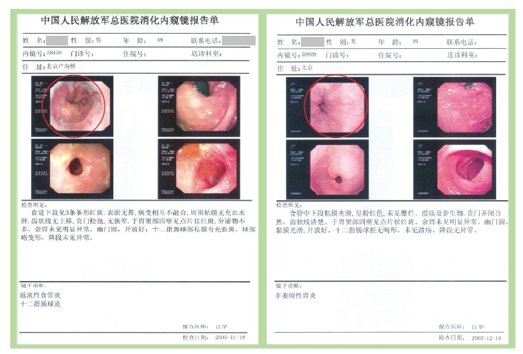 mg冰球突破豪华版(试玩)官方网站