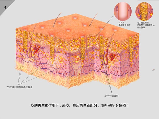 mg冰球突破豪华版(试玩)官方网站