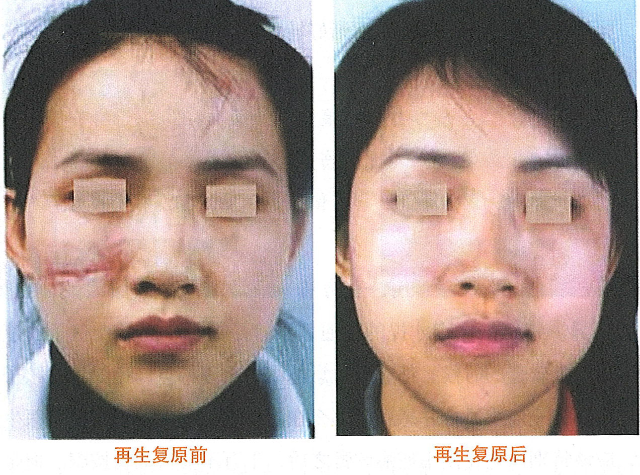 mg冰球突破豪华版(试玩)官方网站
