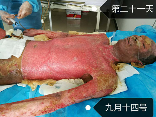 mg冰球突破豪华版(试玩)官方网站