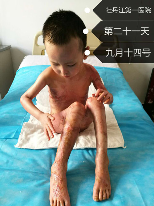 mg冰球突破豪华版(试玩)官方网站
