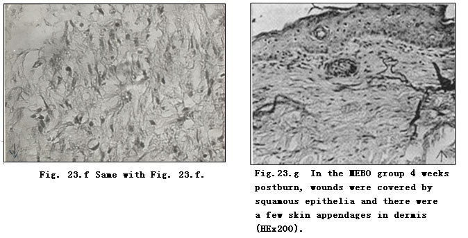 201122316218500