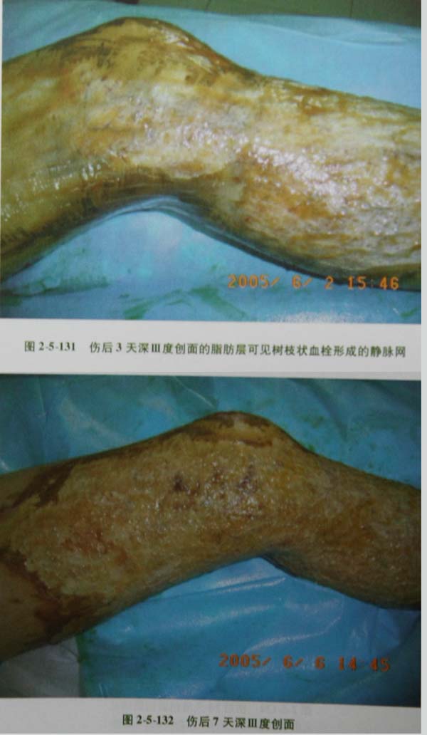 201131154129355