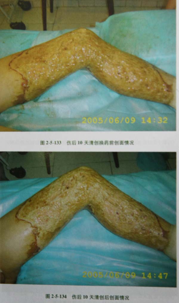 201131154140129
